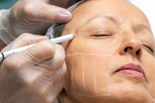 CryoPen: 5 Skin Concerns It May Be Used to Treat 4 What should you ask before having CryoPen treatment Garswood?