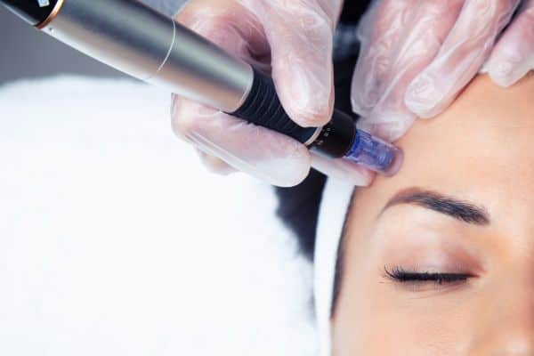 Explaining Total Skin Tightening Treatment and What to Expect 2 What Skin Concerns Can Total Skin Tightening Treatment Help With Garswood?
